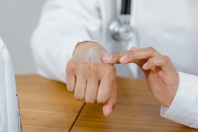 eczema treatment Calgary